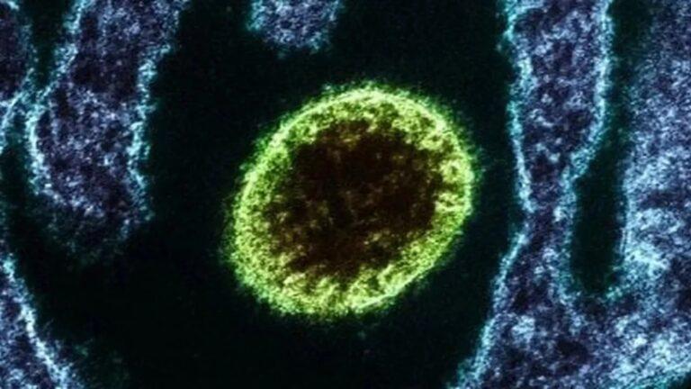 Imagen: Virus Nipah: cinco casos confirmados disparan las alarmas sanitarias